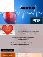 Aritmia Jantung dan Interpretasi EKG