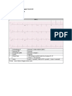 EKG 12 Lead (Sintia Anggun Irmawati 2D - 158)