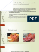 Caso Clínico Pancreatitis Aguda