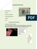 Articulación de Dientes Anteriores