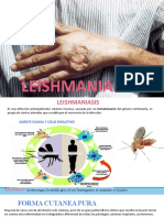 Leismaniasis Presentacion en