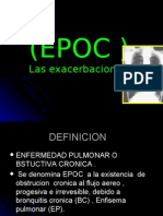 EPOC