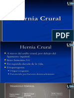 Hernia Crural