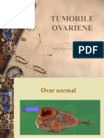 Tumorile Ovariene1-53