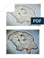 Amiba_micropreparat