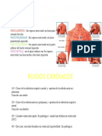 Focos de Auscultación Cardiaca