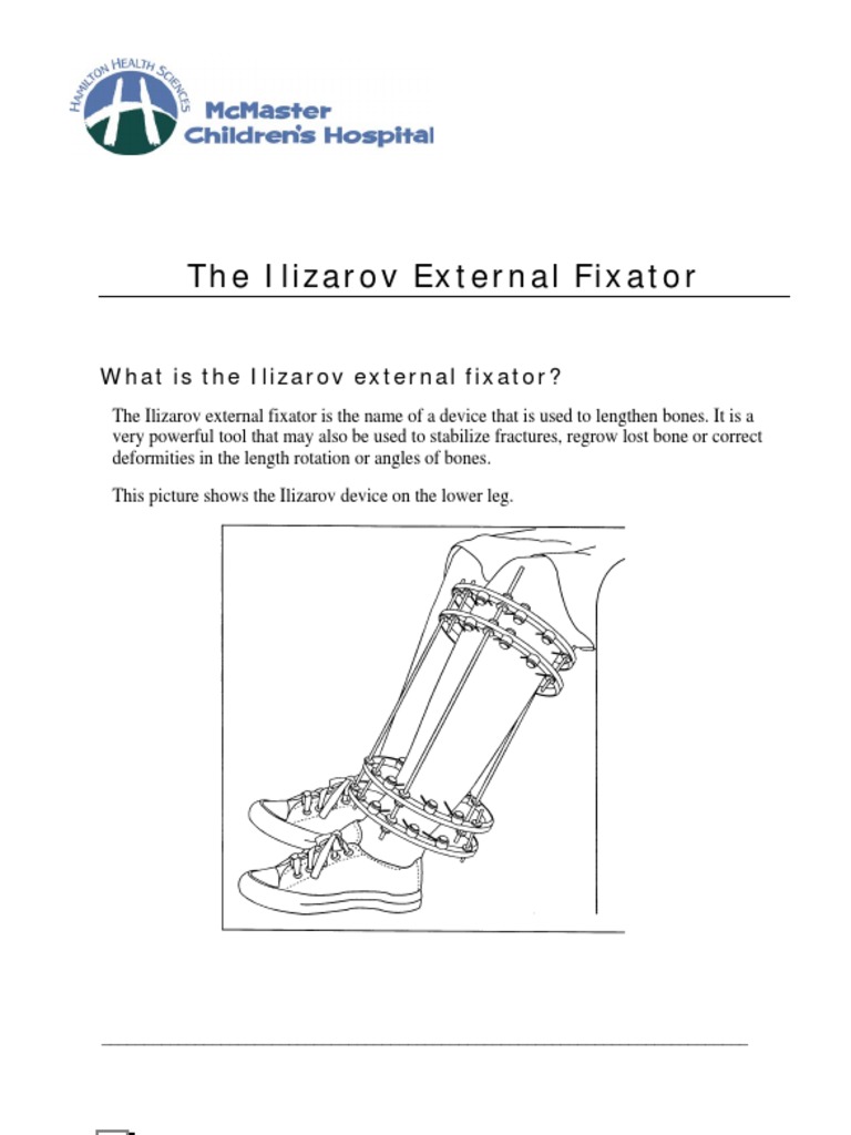 When Should I Call The Surgeon? What Is The Ilizarov External Fixator ...