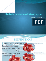 Rétrécissement aortique  (1)