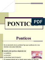 Ponticos y Pilares y Endopostes