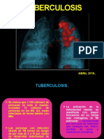 2. Tuberculosis