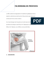 Hipertrofia Benigna de Prostata -Anita 2010