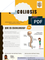 Escoliosis