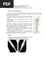 Tratamento Funcional das Fracturas da Diáfise da Tíbia. Madeira Dias, Ana Inês, Pedro Marques, Ciro Costa