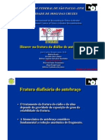 Ilizarov na fratura da diáfise de antebraço. JoséCarlos Bongiovanni, M.D., Hilário Boatto, Osvaldo clinco Júnior, Rubens Augusto Salvadori Martinhão, Marcus Aurelio Preti, Marcelo Fumio Utsunomiya, Diego Bongiovanni, Robson Toshimitsu Kiyohara. 