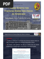 Fixação Externa nas Fracturas Distais dos Ossos do Antebraço.  Pedro Negrão , Miguel Trigueiros, Rui Lemos