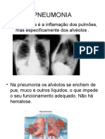 SLIDES PNEUMONIA T12