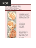 O implante é uma microcápsula flexível