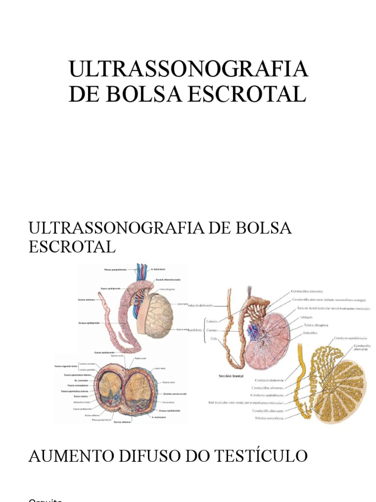 Resumo de Ultrassonografia de Bolsa Escrotal | PDF