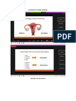 Hemorragia Uterina Anormal