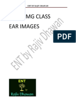 Rajiv Dhawan ENT EAR FMG Images