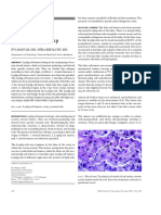 Leydig Cells Tumours