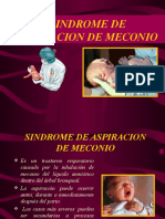 Tema 9 Sindrome de Aspiracion de Meconio