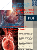 Acute Myocardial Infarction-Ara