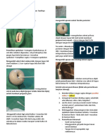 Px. Gyno, Swab Pap Smear Dan Iva, Swab Vagina Bimanual