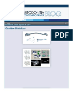 Carrière Distalizer: nova alternativa para distalização