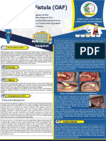 Oro Antral Fistula (OAF) : Rumah Sakit Gigi & Mulut Universitas Baiturrahmah