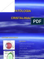 Cataracta + Glaucomul + Refractie Oculară