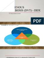 Deep Venous Thrombosis (DVT) - DDX