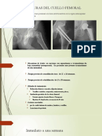 FX de Femur y Patologia de Perthes