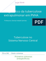 u2a3 - Diagnóstico de tuberculose extrapulmonar em PVHA