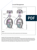 Bell's Palsy_Facial Nerve and Supranuclear lesion