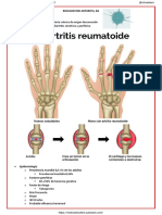 Artritis Reumatoide (Ar) (6p)