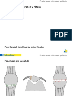 Olecranon rotula 2