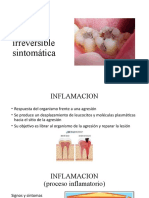 Pulpitis Irreversible Sintomática