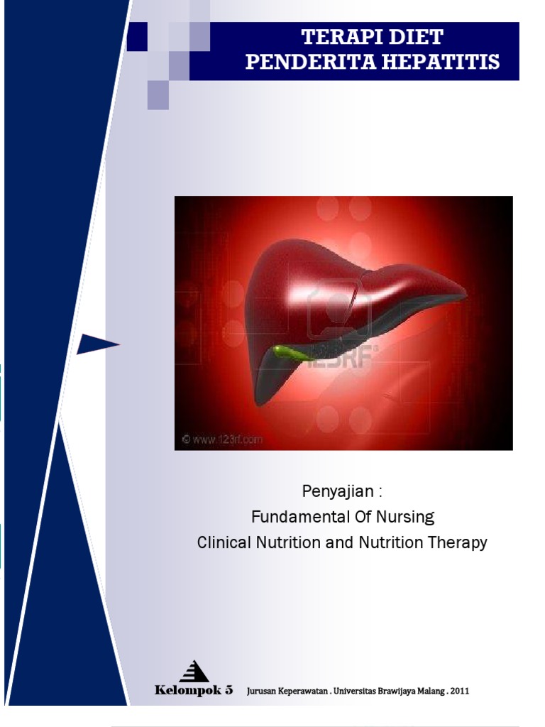 Hati Hati 3 Makanan Ini Ternyata Bukan Vegan Food