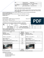 K109. HZ- Muh.Awal- 012-014-97-45_ODS Senile Nuclear Cataract