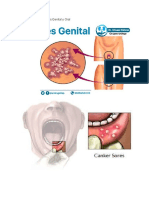 Enfermedad del Herpes Genital y Oral