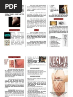 Download Leaflet Infeksi TORCH by Dea Pratami SN56927563 doc pdf