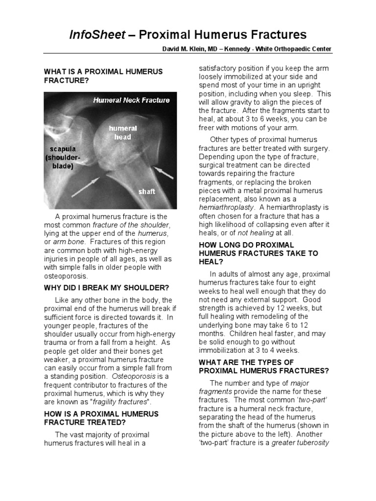 Proximal Humerus Fractures Overview | PDF | Shoulder | Elbow