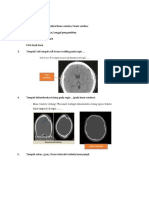 Cara baca CT scan kepala