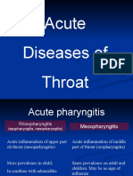 Острые заболевания глотки - en