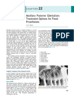 Maxillary Posterior Edentulism: Treatment Options For Fixed Prostheses