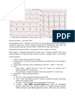 EKG Laki-laki 65 thn: Sinus Rhytm + LBBB + LAE + LVH