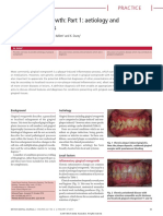 Gingival Overgrowth: Part 1: Aetiology and Clinical Diagnosis