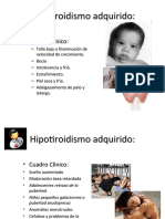 Hipotiroidismo Adquirido (Cuadro Clinico)
