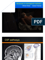 Advances Craniospinal Irradiation